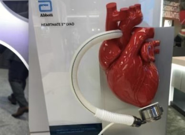 首款国产介入式人工心脏来了