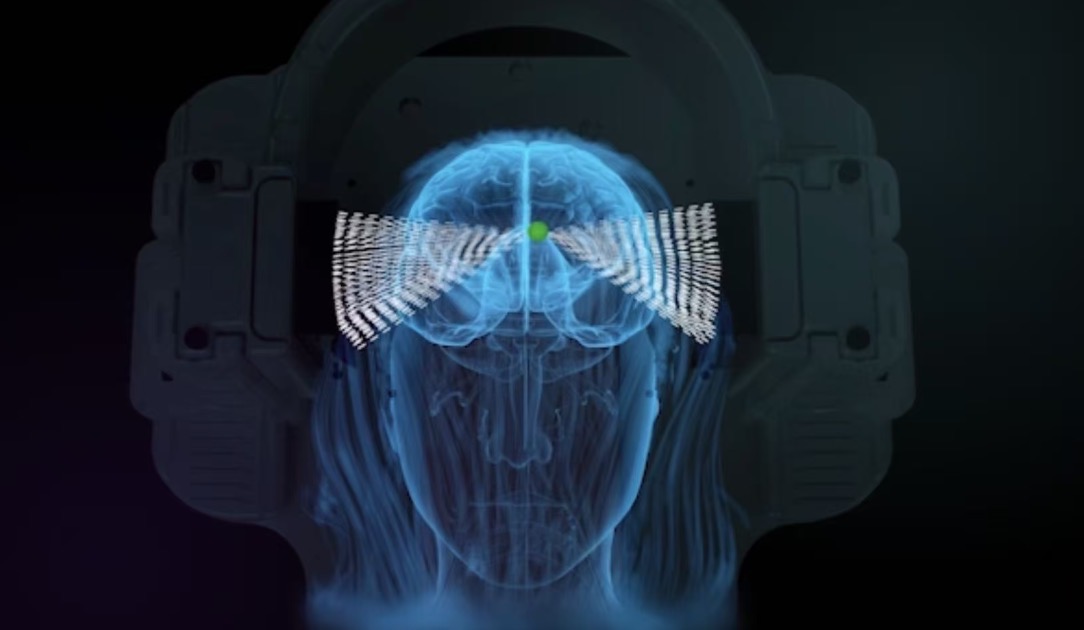 陈天桥再投资!押注中国首家超声波脑机接口公司 陈天桥再投资!押注中国首家超声波脑机接口公司